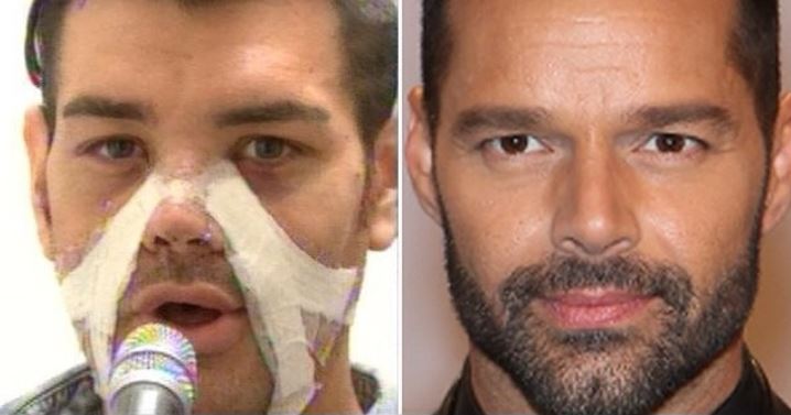 increible-argentino-se-opera-27-veces-para-parecerse-a-ricky-martin