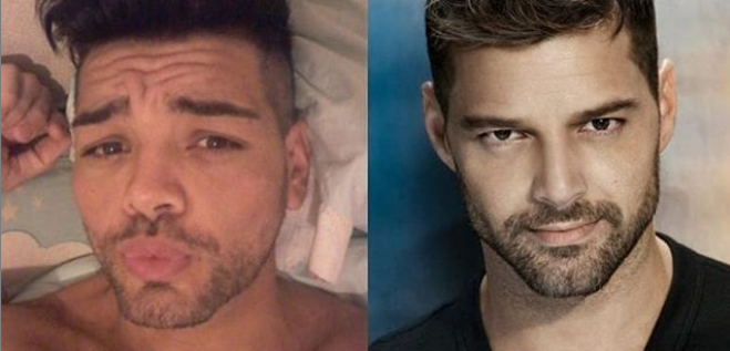 argentino-se-sometio-30-cirugias-para-verse-como-ricky-martin