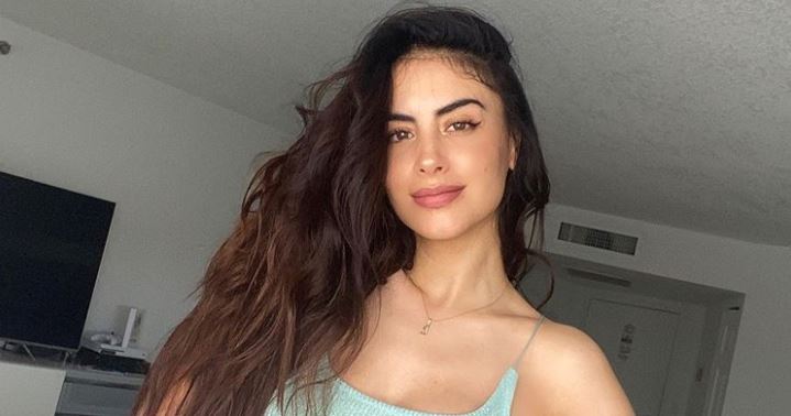 Jessica Cediel publicó una foto de su nalga después de 6 meses de su cirugía